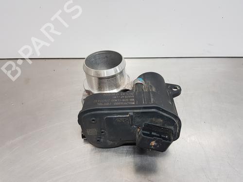 Throttle body PEUGEOT 2008 II (UD_, US_, UY_, UJ_, UR_, UC_) 1.2 PureTech 130 (USHNS, URHNS) | BP29591511M82 
