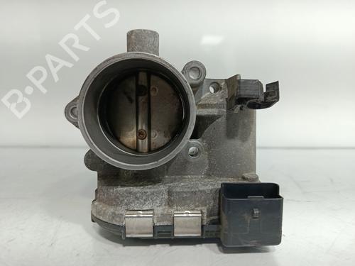 Used Throttle body PEUGEOT 307 (3A/C) 1.6 16V (109 hp) 29984089