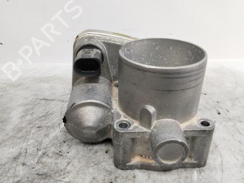 Throttle body VW GOLF IV (1J1)  | BP25928680M82