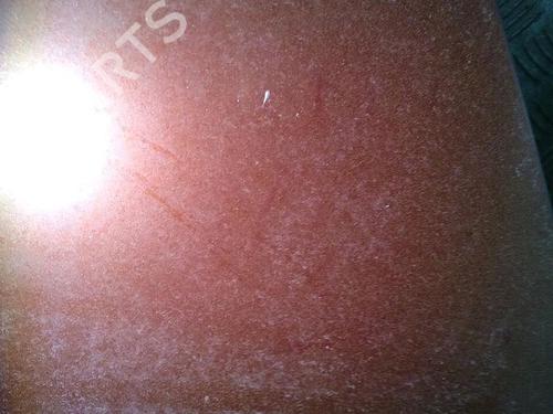 Used Hood VOLVO C30 (533) 1.6 D (109 hp) 30064348