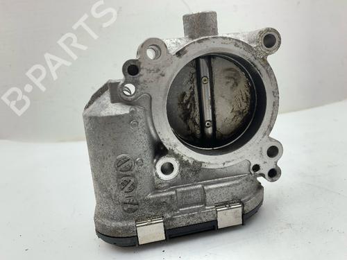 Throttle body MERCEDES-BENZ A-CLASS (W169) A 170 (169.032, 169.332) | BP32472578M82