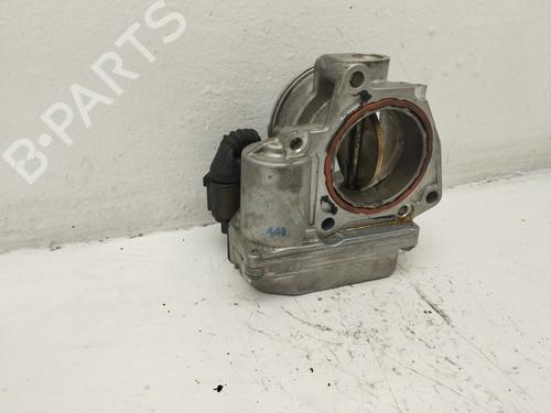 Throttle body AUDI A4 B7 (8EC) 2.0 TDI 16V | BP40265176M82 - Image 2