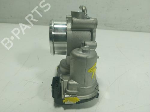 Throttle body KIA STONIC (YB)  | BP17955135M82 