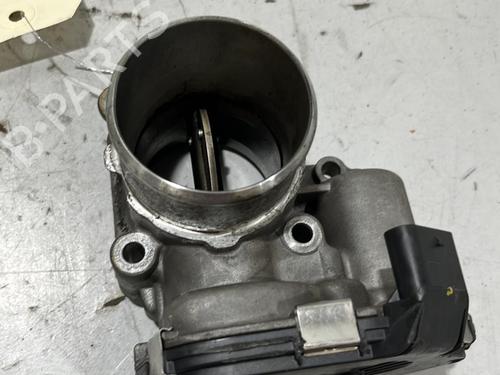 Throttle body HYUNDAI i20 II (GB, IB) 1.4 CRDi | BP22576384M82 