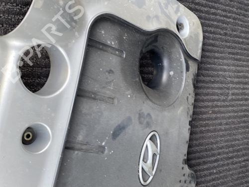 upper-protection-hyundai-santa-fe-ii-cm-2005-2006-2007-2008-2009-2010-2011-2012-2013-2014-2015-30133228 main image