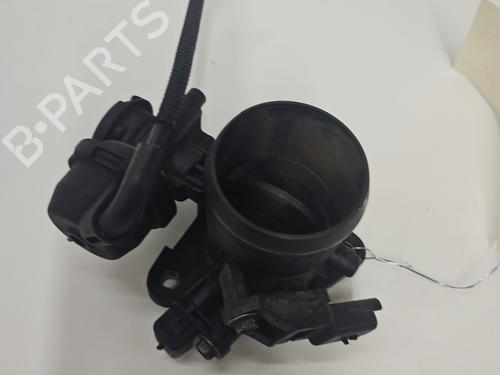 Used Throttle body Throttle body PEUGEOT 407 (6D_) 2.0 HDi 135 (6DRHRH, 6DRHRE, 6DRHRG, 6DRHRJ) (136 hp) 33565649 33565649
