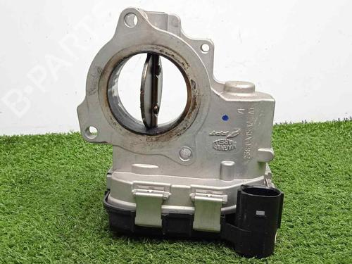 Throttle body ALFA ROMEO STELVIO (949_) 2.2 D (949.AXC1A) | BP17319159M82 