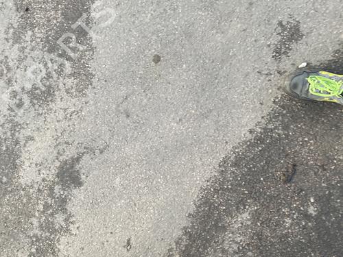 Hand brake KIA STONIC (YB) 1.0 T-GDi | BP25910718I18  - Image 5