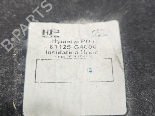 Upper protection HYUNDAI i30 (PDE, PD, PDEN) | BP37827876M93 - Image 3